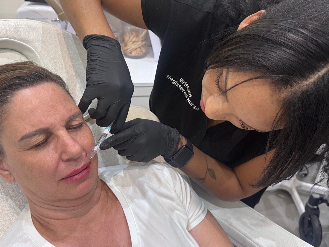 Cheek filler treatment at Soluxe
