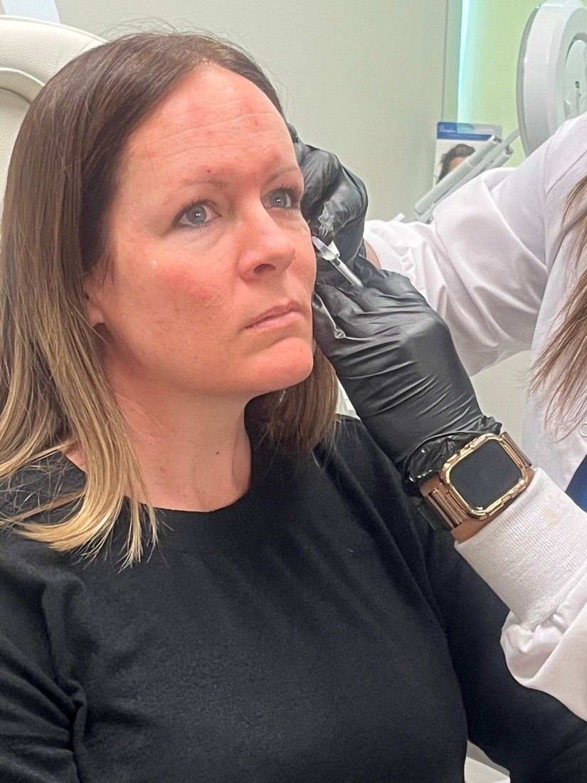 PDO thread treatment at Soluxe